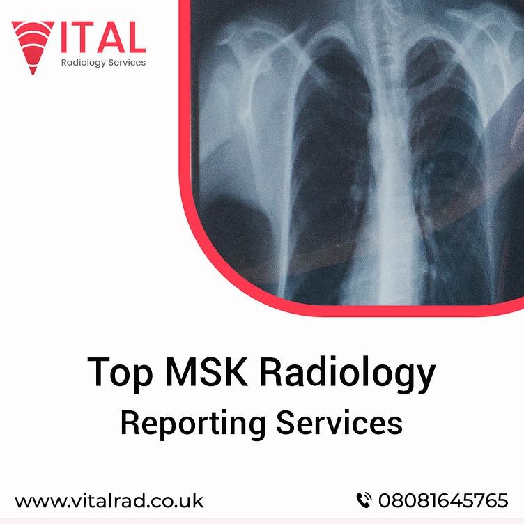 Top MSK Radiology Reporting Services by Vital Radiology Services on