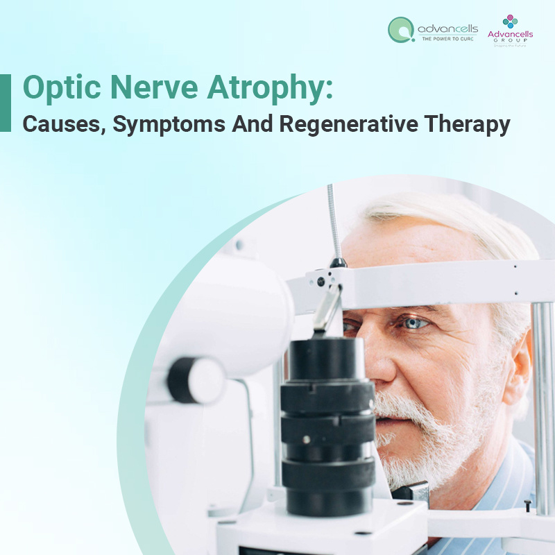 Optic Atrophy Treatment in India by Advancells Stem Cell Therapy on
